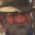 Lumbago