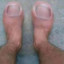 Toes