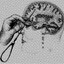 lobotomy