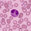 Eosinophil