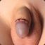 &lt;-----Beisst dich