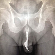 Richard Fork - steam id 76561199537538591