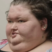 Autizmo