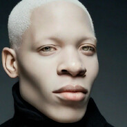 Albino negro