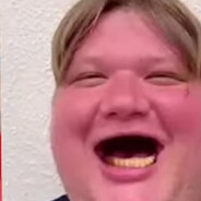 P1mple