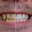 Colgate