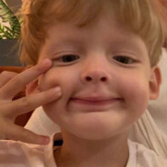 好想被艾许阻胶