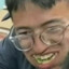 蚊子叮damn