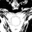 The Living Tribunal