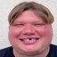 p1mple
