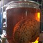 brain in a jar