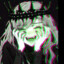 {LTU} Euphoria