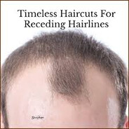 receding hairline