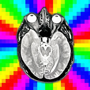 Analog AI Psychosis