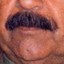 Saddam&#039;s Mustache