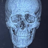 Мастур Бист