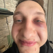 No scope