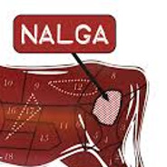 Tapa de Nalga 13