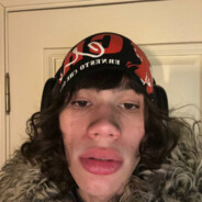 DEN1S
