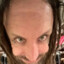 Foreskin johnny