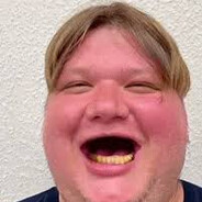 s1mpleAposentadoSkins