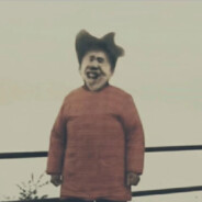 不打麻药割剥皮