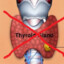 Thyroid Hunter