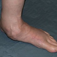 DeadFeet - steam id 76561197971110933