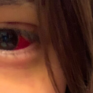 síndróme de estrangulación