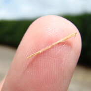 пенисная заноза