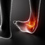 Ankle