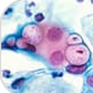 [BIT]Chlamydia avatar