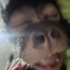 Fonite