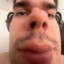 klioxzer