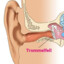 Trommelfellplatzer