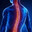 Scoliosis