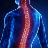 Scoliosis