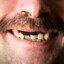 SNUS