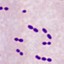 Streptococcus pneumoniae