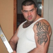 Hiperpigmentált_Dakota