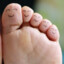 Toes