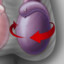 Torsion Testicular