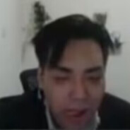 蛋叔海胆偷袭中国眯眯