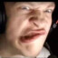 supernova PRCKO