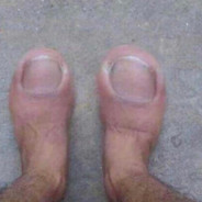 TOE