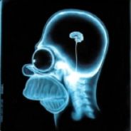 Brain Matter ¦ вlϊтz - steam id 76561197964523773
