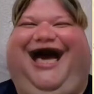 симпл димпл