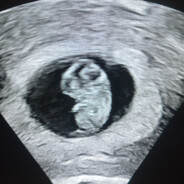 Irish [Magic Spy]'s avatar