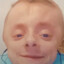 420