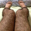 HAIRY LEGS